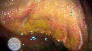 gastric ulcers in horses the important