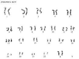 Zooweb Karyotypes 47 Xx 13