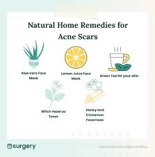 home remes for acne scars