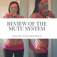 mutu system and diastasis recti