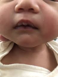 dry milk on bub s lips babycenter