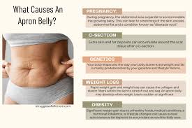 say goodbye to a belly the no