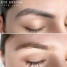 permanent makeup removal methods