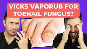 ointment to cure toenail fungus
