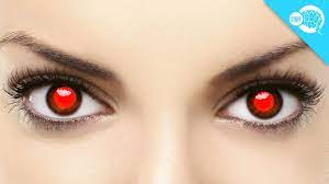 what causes red eye in photos you