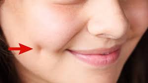 how to get dimples fast and naturally