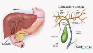 gallbladder surgery side effects