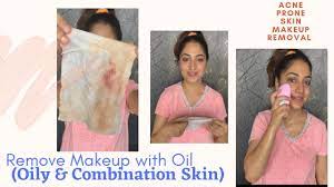coconut oil for acne e skin