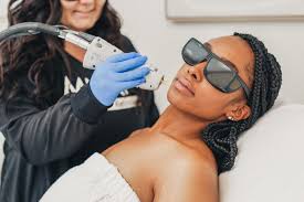 laser hair removal 101 before during
