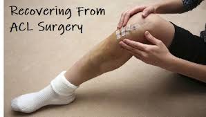 recovery after acl surgery knee pain