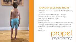 what are the signs of scoliosis in kids