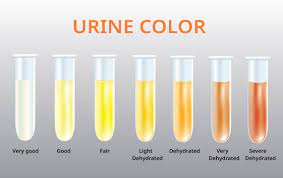 urine color images browse 7 946 stock