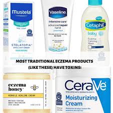 natural eczema remes for es