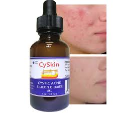 acne cystic skin treatment cyskin