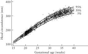 Sex Specific Antenatal Reference Growth Charts For