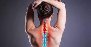 NYC Spinal Stenosis Treatment, Symptoms | Midtown Pain Relief | UES