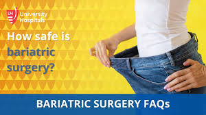 bariatric surgery faqs how safe is
