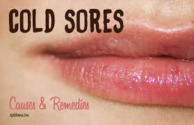 cold sores fever blisters causes