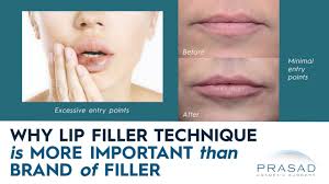 what is the best lip filler dr