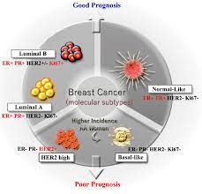 Different molecular subtypes of breast cancer. | Download Scientific Diagram