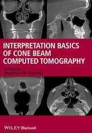 cone beam computed tomography wiley