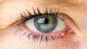 here s what s really causing your stye