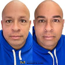 eyebrow microblading for men
