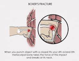 fracture symptoms treatment surgery