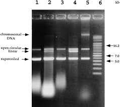 gel electropsis of plasmid dna