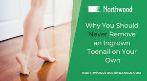remove an ingrown toenail