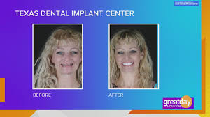 the texas dental implant center can