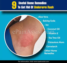 home remes to get rid of underarm rash