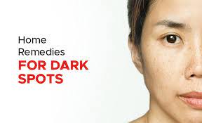 home remes to remove dark spots on