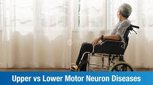 upper vs lower motor neuron diseases