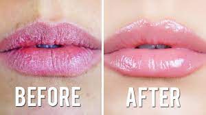 chapped lips remedy you