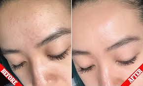 First, take off your lash extensions carefully. Baby Shampoo As Face Wash Reddit Online