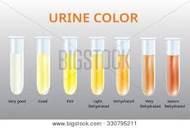 Urine Color Chart Vector Photo Free Trial Bigstock