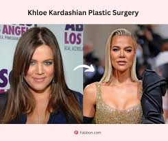 khloe kardashian plastic surgery