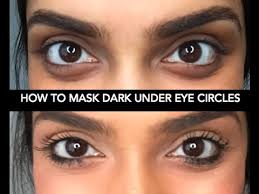 how to cover dark under eye circles