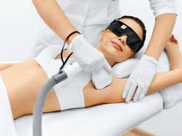 laser hair removal in singapore