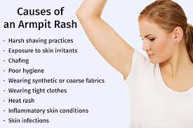 armpit rash causes symptoms