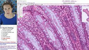 Is that colon is (obsolete) a husbandman while intestine is (obsolete) internal. Digestive Histology 6 Large Intestine Youtube