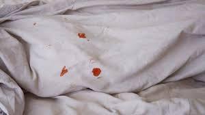 remove dried blood stains from sheets