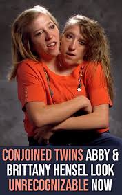 The story of abby and brittany hensel, the famous conjoined twins who learned to live in balance and harmony with each other, is truly inspiring. Pin On Zapisane Przeze Mnie