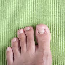 why do toenails fall off learn more