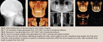 cbct clinical s in