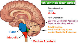 ventricles of the brain labeled
