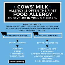 Discover ripple milk and flavors it comes in! 4 Unexpected Signs You May Have A Dairy Allergy Switch4good