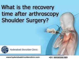 after arthroscopy shoulder surgery