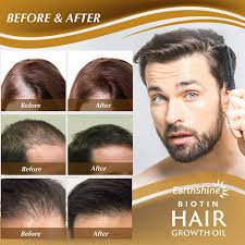 hair growth serum biotin hair